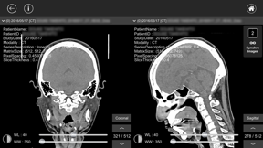 DICOM Viewer : eMma screenshot