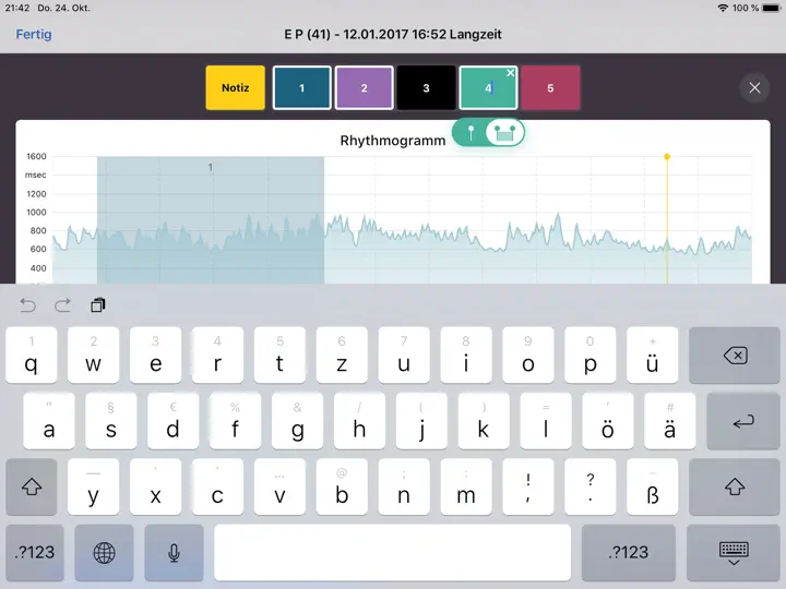 Screenshot von VNS Analyse auf dem iPhone 2