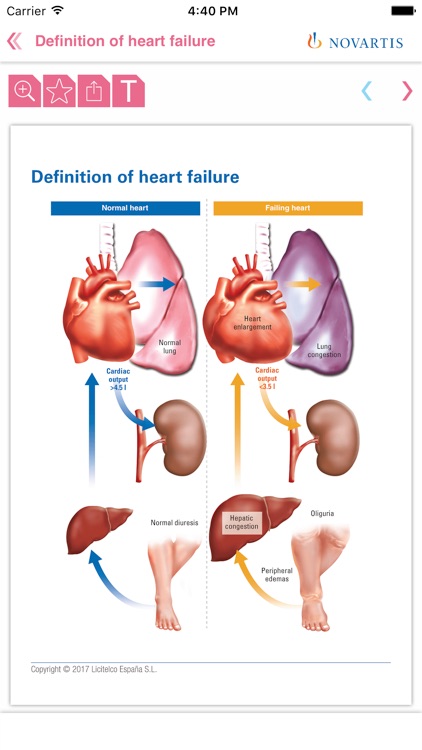 Heart failure Mini Atlas screenshot-4