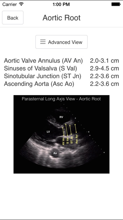 Pocket Emergency Ultrasound screenshot-4
