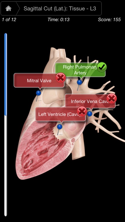 Heart Pro III - iPhone screenshot-4