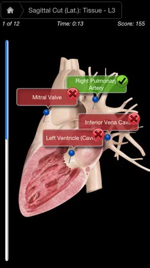 Heart Pro III - IPhone iPhone Screenshot 5