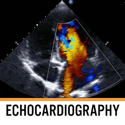 Echocardiography Textbook Cheats