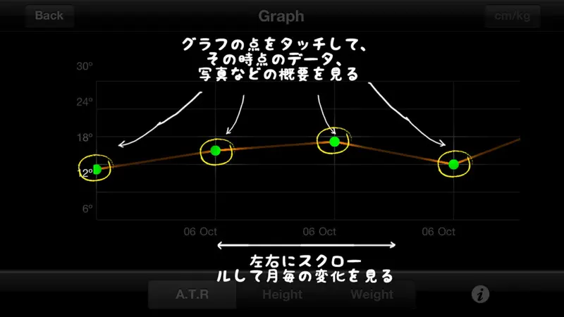 ScolioTrack (脊柱側弯計) screenshot 10 of 10