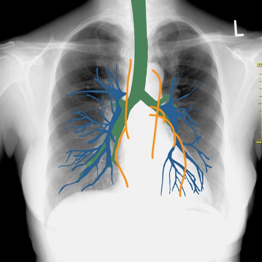 simu.Doc 画像診断シミュレーター