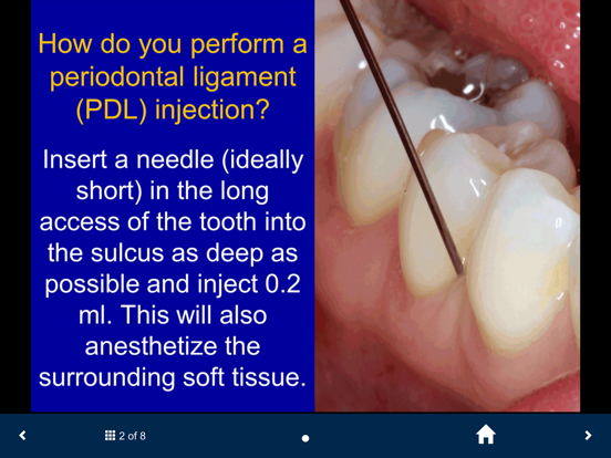 Dental Anesthesia-SecondLook iPad screenshot 5 - Medical app