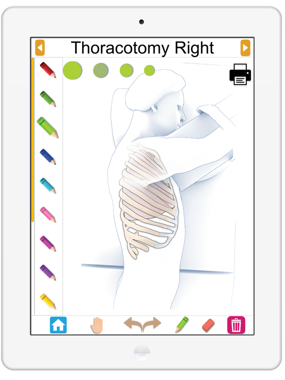 Screenshot #6 pour Surgical Anatomy of the Lung