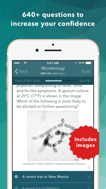 USMLE Step 1 Practice Q&A