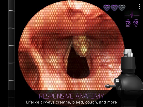 Airway Exのおすすめ画像2