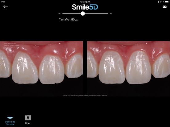 Screenshot #4 pour Smile5D