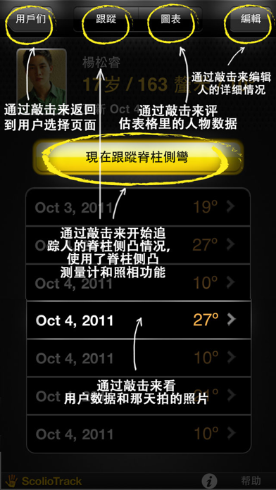 脊柱侧弯跟踪 (ScolioTrack) screenshot