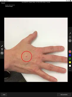 Veradigm EHR Clinical Images iPad image 4