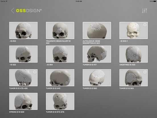 Screenshot #6 pour OssDsign Clinical Case Gallery