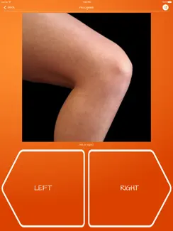 Recognise Knee iPad image 2