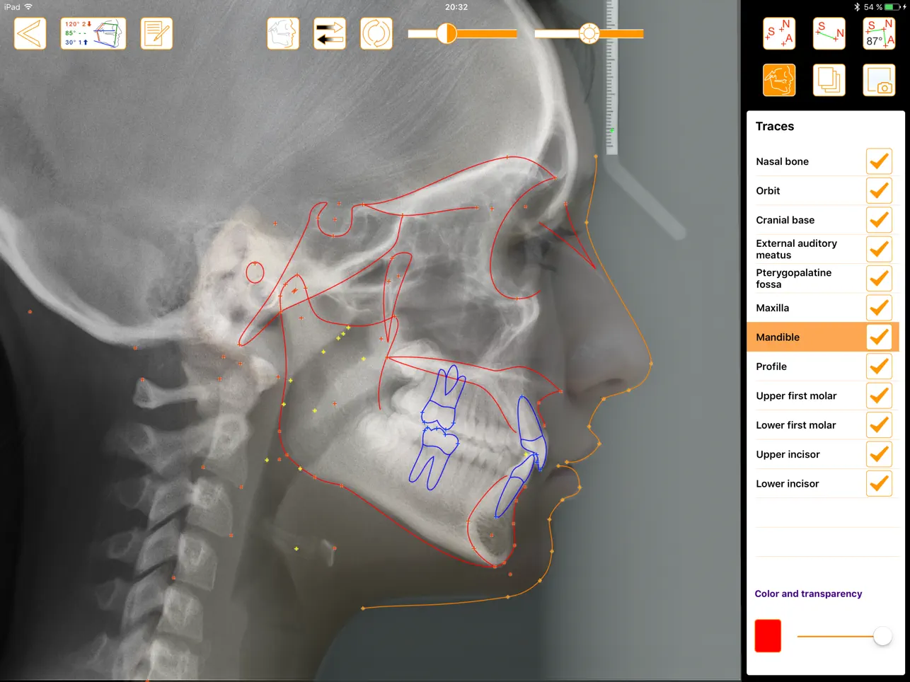 Screenshot #4 pour OrthoLine: Learning