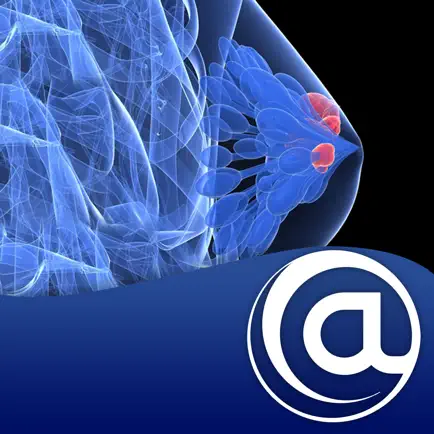 Breast Cancer (BC) Cheats