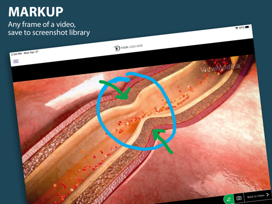 Screenshot #5 pour ViewMedica