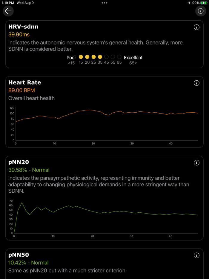 ECG heart analyze - watch