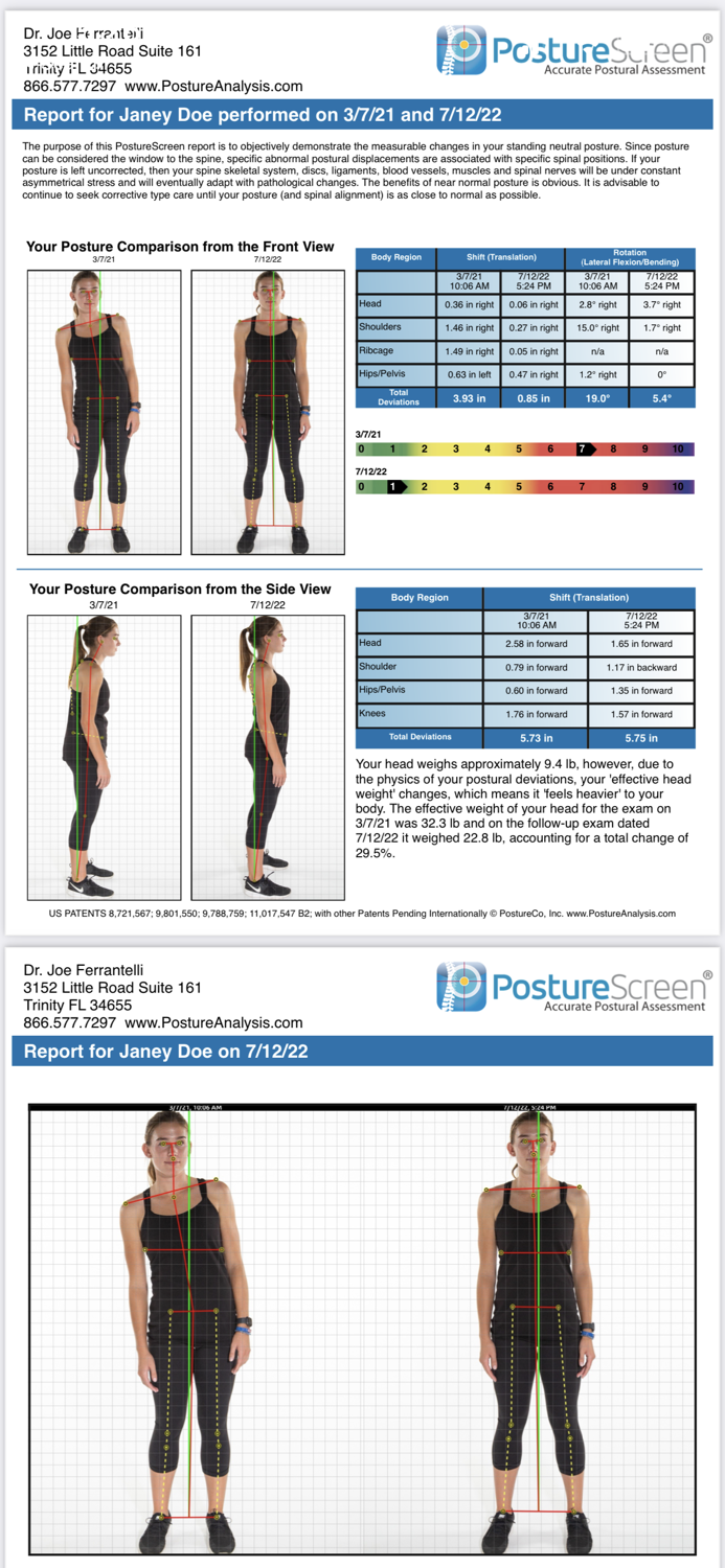 PostureScreen Mobile