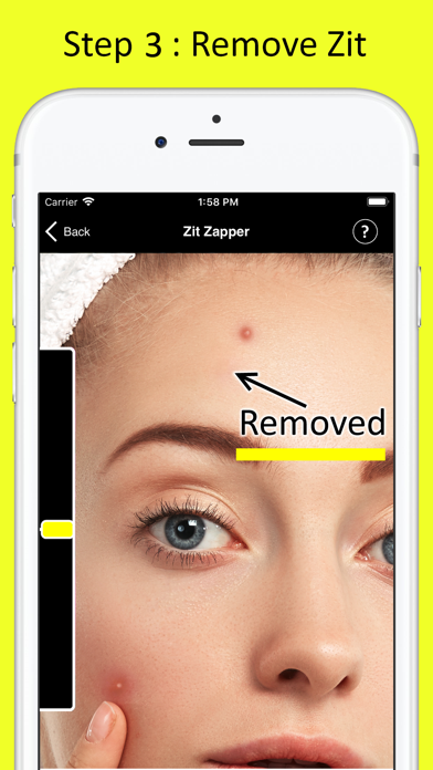 Zit Zapper - Remove Pimplesのおすすめ画像4