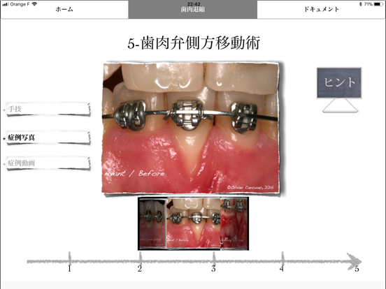 iMuco Récessions gingivalesのおすすめ画像3