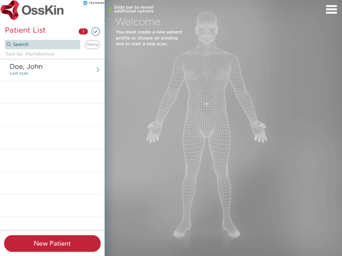 OssKin 3D Scan