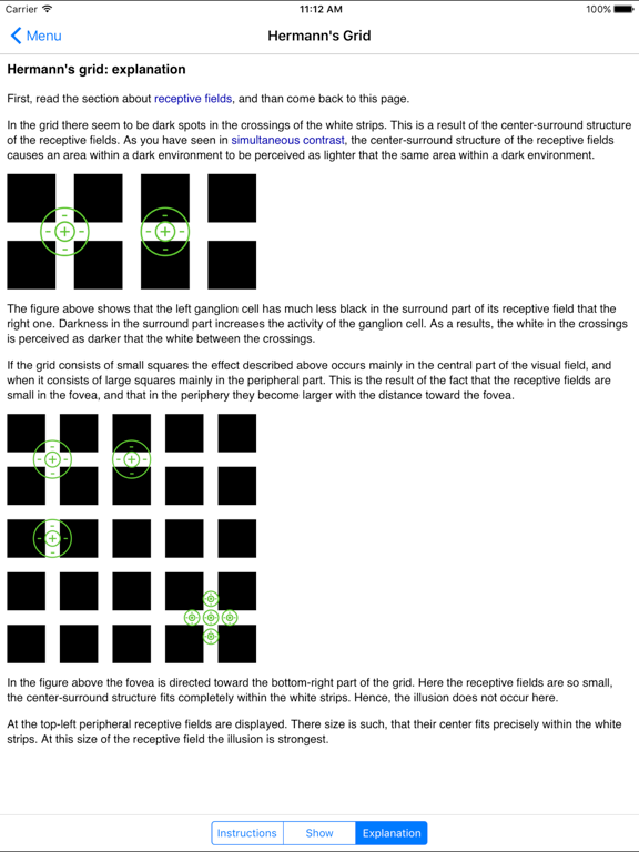 Visuallusion iPad screenshot 4 - Medical app