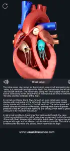 My Heart Anatomy screenshot #4 for iPhone