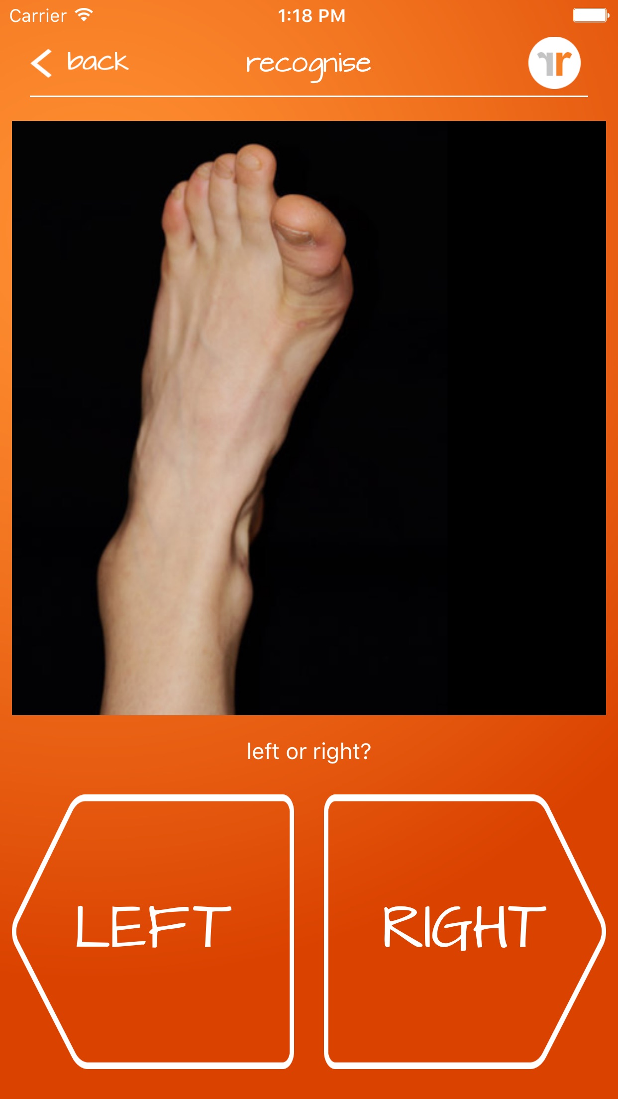 Screenshot 2 of Recognise Foot