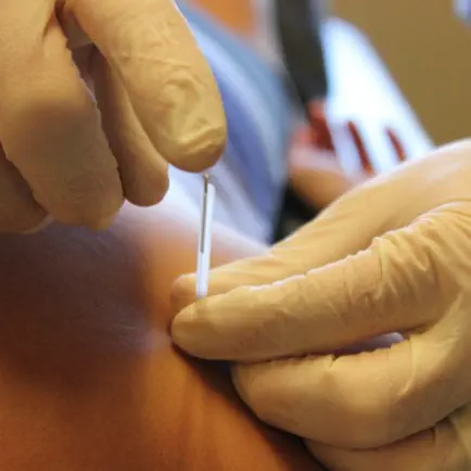 Dry Needling Clinic Companion Читы