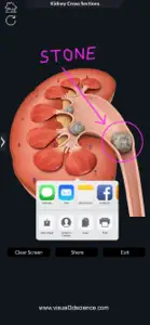 My Kidney Anatomy screenshot #6 for iPhone