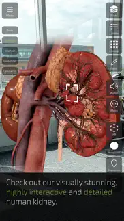 insight kidney iphone screenshot 3