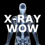 X-Ray Wow App Cancel