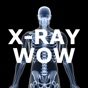 X-Ray Wow app download