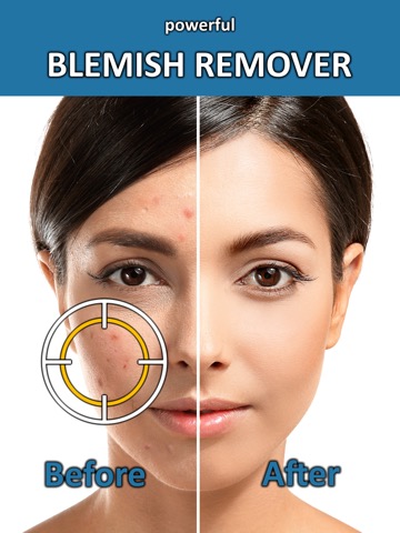 Blemish Remover Photo Toolのおすすめ画像1