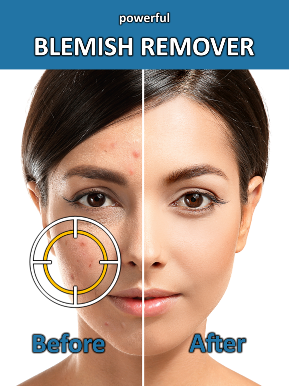 Screenshot #1 for Blemish Remover Photo Tool
