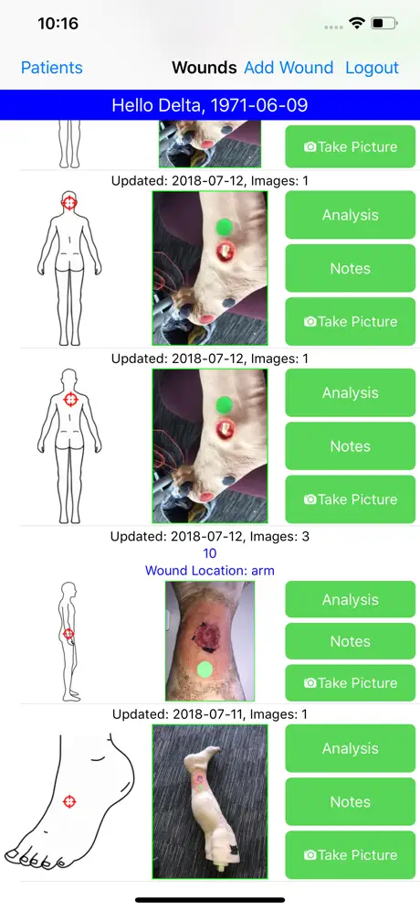 Tissue Analytics