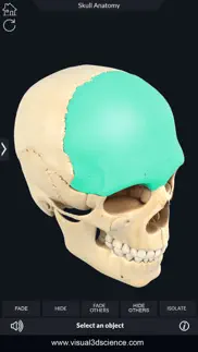 my skull anatomy iphone resimleri 2