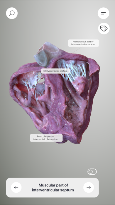 3D Heart Anatomyのおすすめ画像9