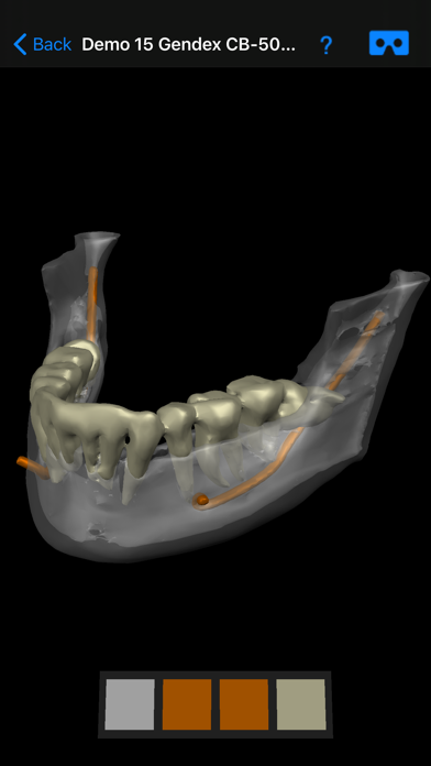 Dental CT View Screenshot