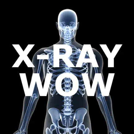 X-Ray Wow Cheats
