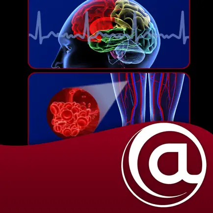 Stroke Prevention in AFib Cheats