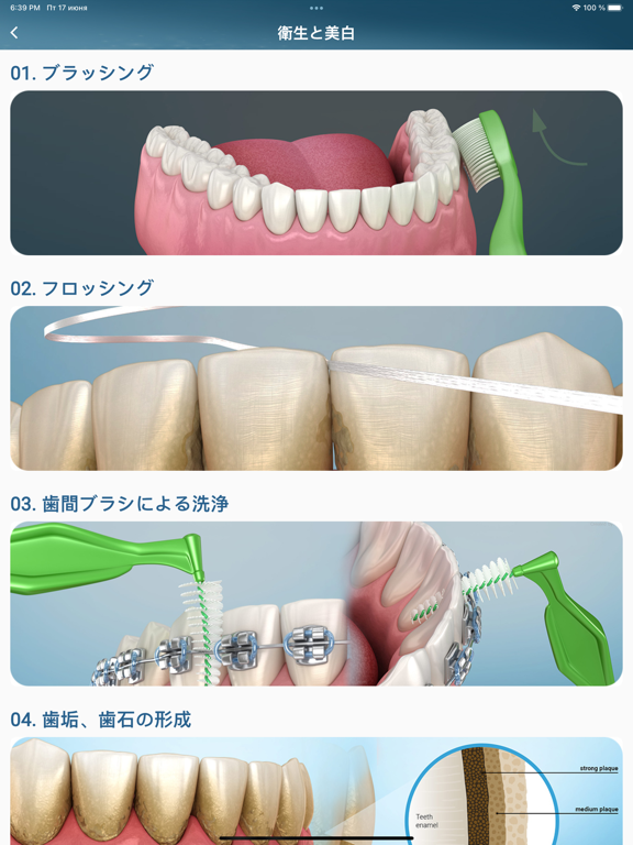 Dental 3D Illustrationsのおすすめ画像2