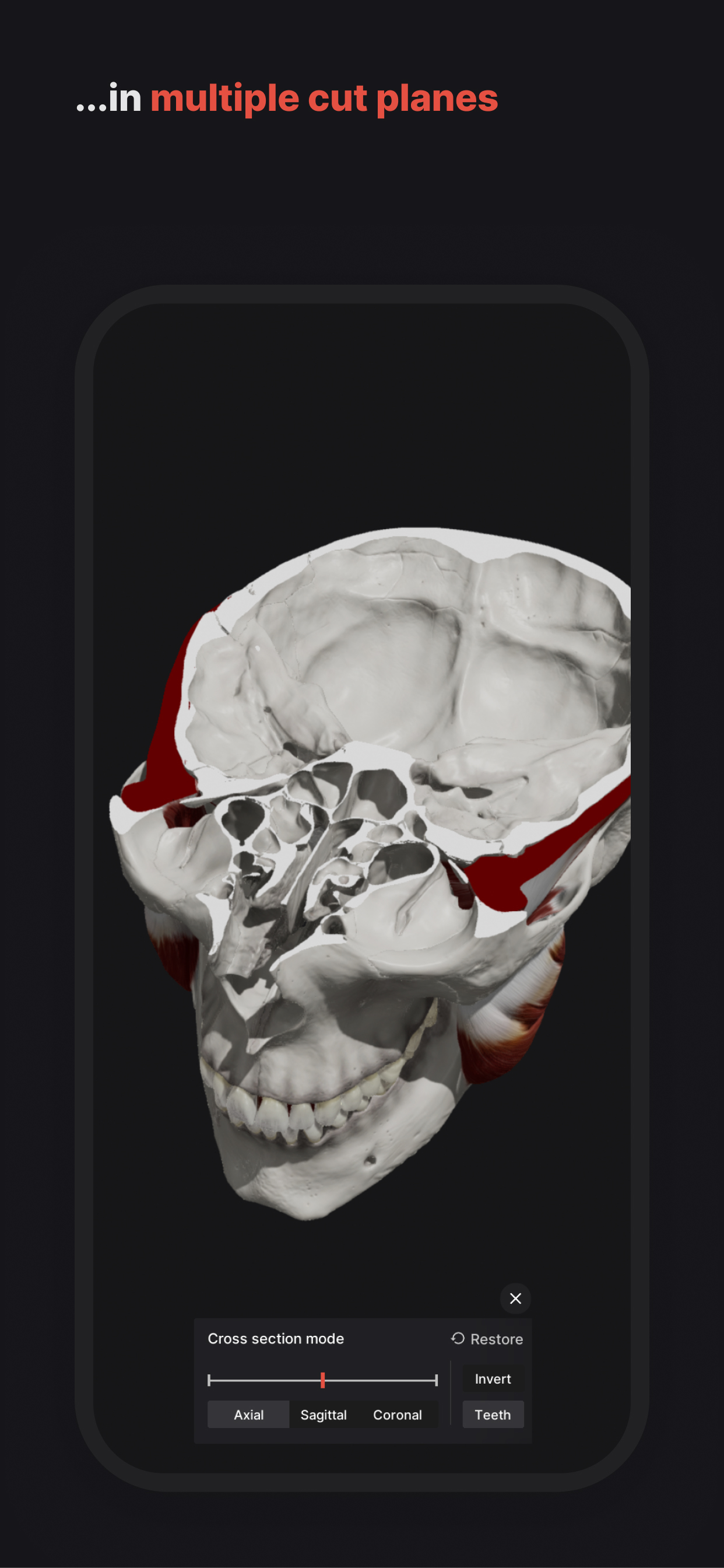 Skull, Teeth & TMJ