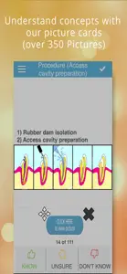 Endodontics Cram Cards screenshot #2 for iPhone