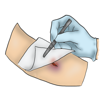 Wound Care MCQ - Best Surgical Education, LLC