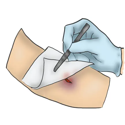 Wound Care MCQ Cheats