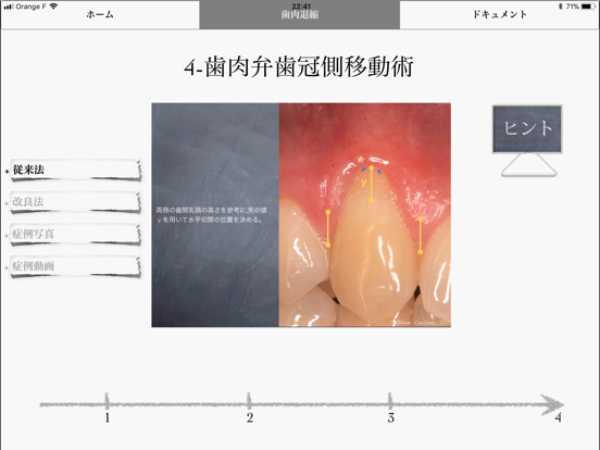 iMuco Récessions gingivalesのおすすめ画像2