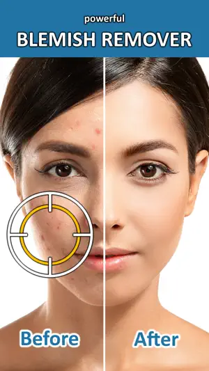 Blemish Remover Photo Tool screenshot 1