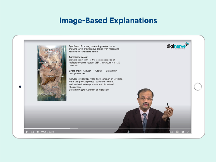 DigiNerve –Medical Learning